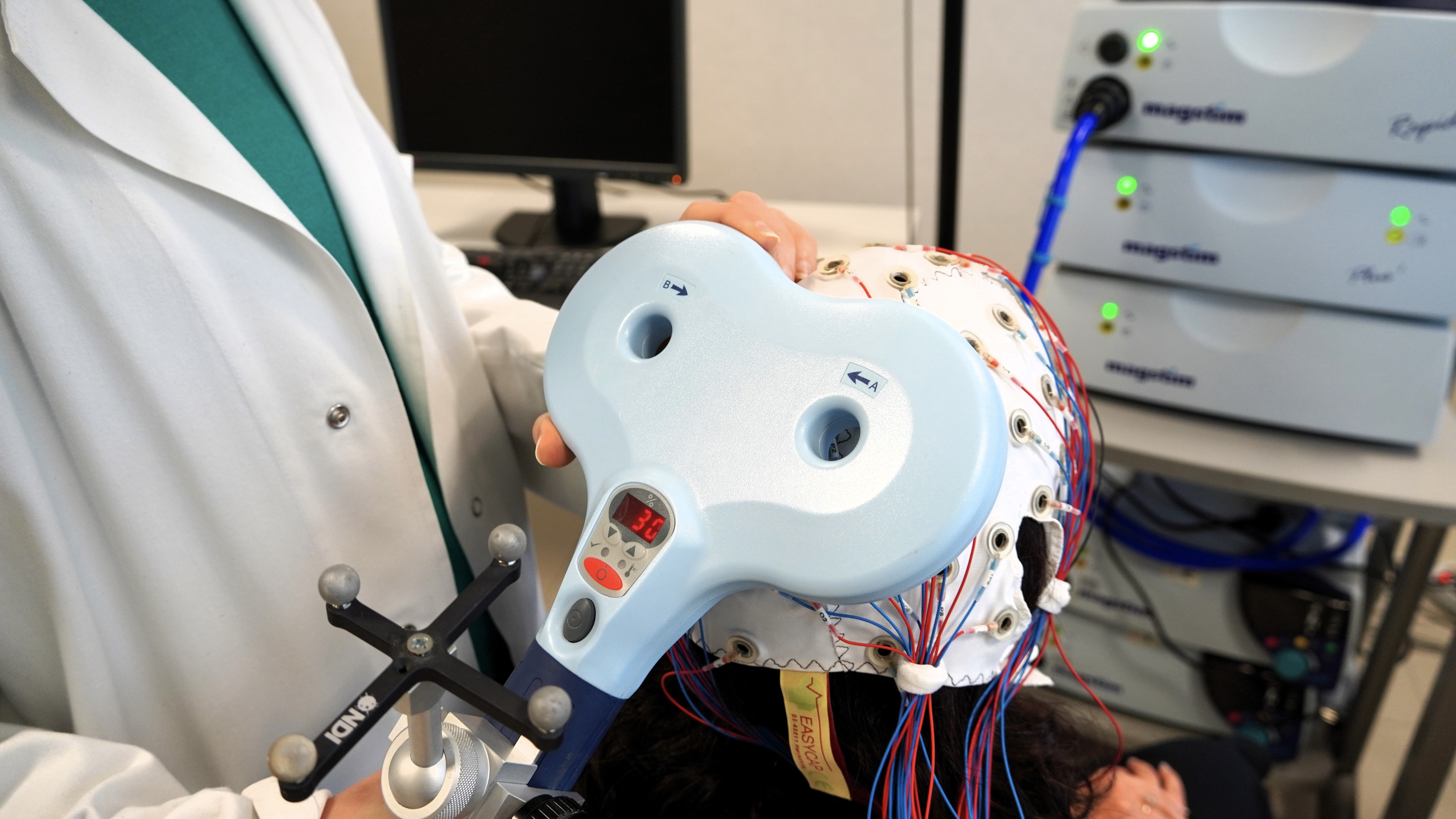 gallery Alzheimer: la Stimolazione Magnetica Transcranica dimezza la progressione della malattia 