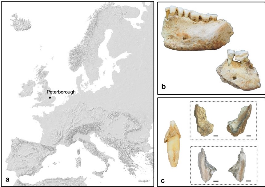 gallery Lo zenzero come ingrediente medicinale nella cura della lebbra nell’Europa medievale