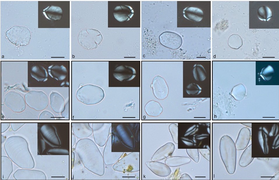 gallery Lo zenzero come ingrediente medicinale nella cura della lebbra nell’Europa medievale