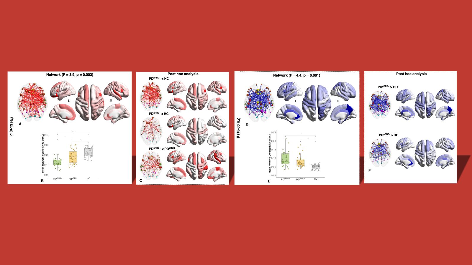 gallery Parkinson: grazie a EEG potenziato, nuova mappa del cervello